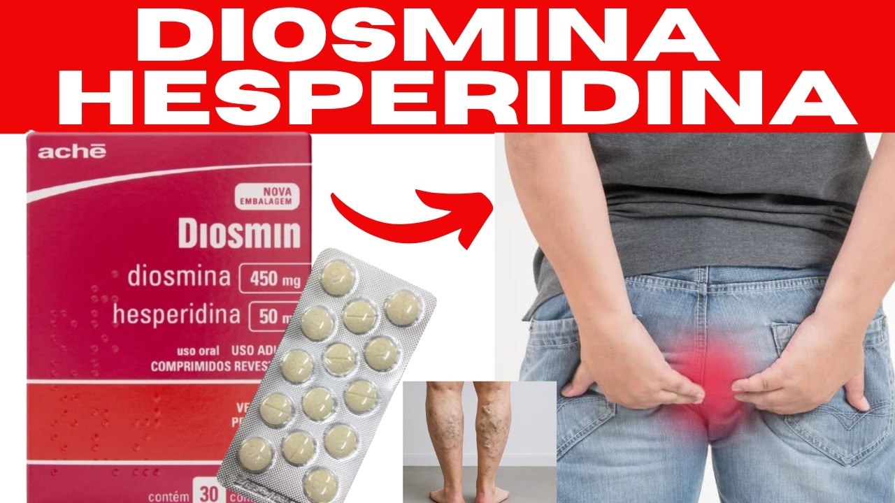DIOSMINA HESPERIDINA - PARA QUE SERVE, COMO USAR, EFEITOS COLATERAIS ...