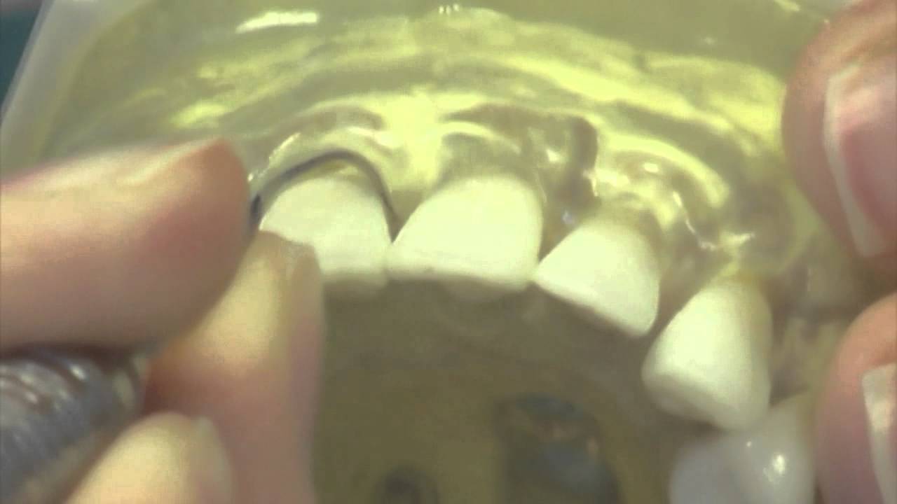 WSU Dental Hygiene How to Use the Explorer YouTube