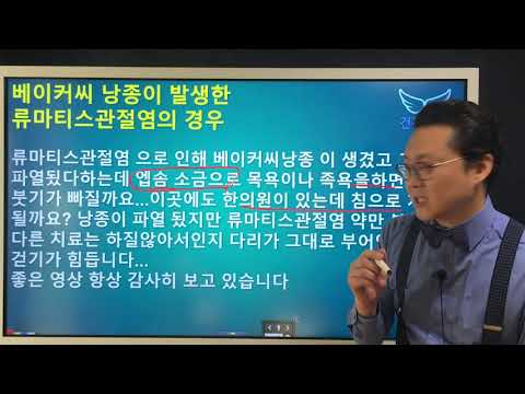 베이커씨 낭종이 발생한 류마티스관절염의 치료와 관리 Baker&amp;#39;s cyst &amp;amp; <strong>Rheumatoid</strong> <strong>Arthritis</strong>