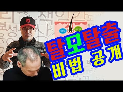 ✂ 탈모 탈출 실제 상황 비법공개! 대머리탈출 (50대 유튜버 탈모치료해법,탈모샴푸,다이어트,디톡스,해독,청소년탈모,남성탈모,실버탈모)Bald Hair Treatment