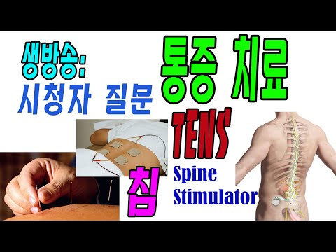 시청자 질문 생방송: <strong>통증치료</strong>= MSM, 침,TENS, spine stimulator