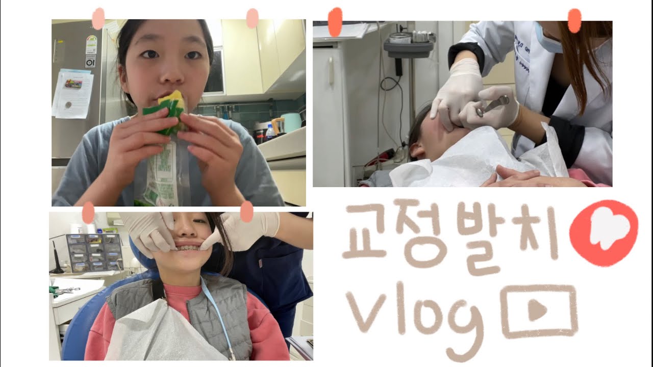 교정발치 vlog🥲🥲