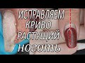 НОГТЕВЫЕ ПОКУПКИ // ИСПРАВЛЯЕМ КРИВОРАСТУЩИЕ НОГТИ