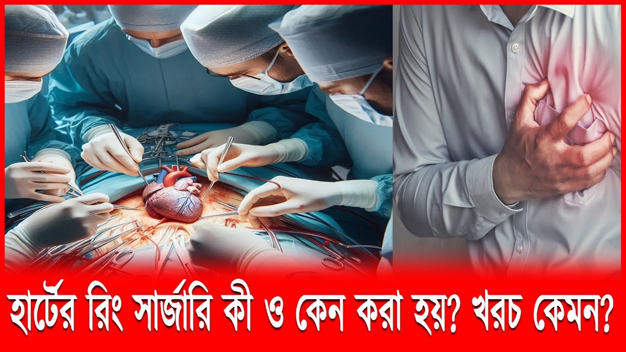 হার্টের রিং সার্জারি কি?||বাংলাদেশে খরচ কত?|| বিস্তারিত জানুন!|| heart ring surgery