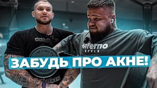 Бобоев Дмитрий и Илья Голубочкин - тренировка дельт. От чего акне и как с ним бороться.