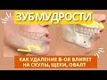 ЗУБ МУДРОСТИ! Как удаление 8-ок влияет на скулы, щеки, овал? Упражнение «Треугольник из языка»