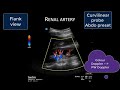 Solid Organ Doppler Assessment of Venous Congestion