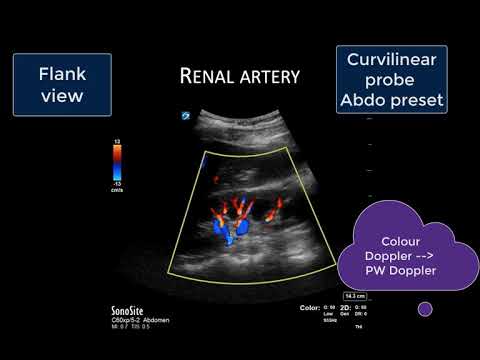 Solid Organ Doppler Assessment of Venous Congestion