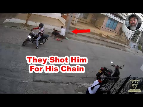 Moto Robbers Shot Man In The Leg For His Chain