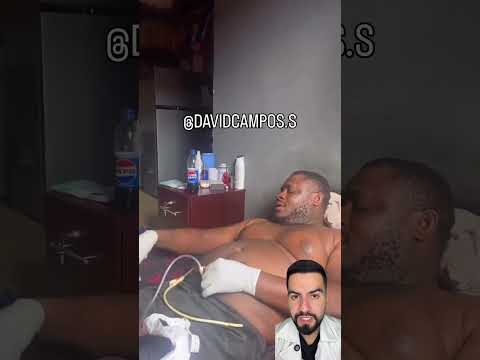 CATÉTER EN LA VEJIGA