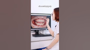 Tư vấn ca niềng mất răng số 6 | Lạc Việt Intech Niềng Răng #shorts