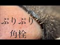【定期】毛穴パック＋ピンセット