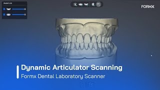 Dynamic Articulator Scanning with  Formx Dental Lab Scanner