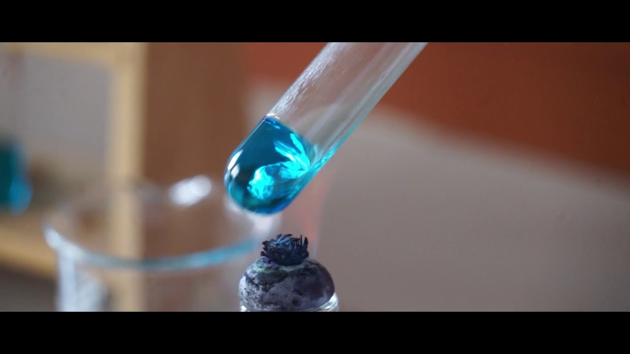 Pemeriksaan Kimia Klinik - Glukosa Urine (STIKES WIRA MEDIKA - BALI) #ON_TLM2020