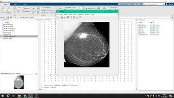 MATLAB ile Görüntü İşleme Ödevi L3 imajlarda ön işlemler, filtreleme, imbothat