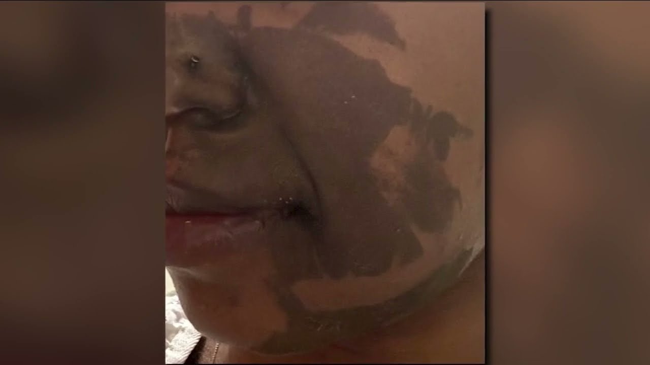 Woman burned by chemical substance in Brooklyn subway station