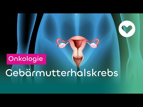 Video: 3 Möglichkeiten zur Behandlung von Gebärmutterhalskrebs