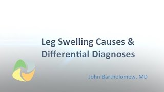 Leg Swelling Causes & Diagnoses