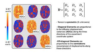 37. Diffusion 1: DTI Basic Principles (Diff E2)