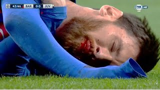 The Day Lionel Messi nearly DIED on the Pitch!