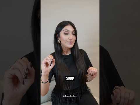 Botox Eyelid Droop.. Let’s Chat! 🤔