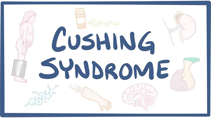 Cushing Syndrome - causes, symptoms, diagnosis, tr...