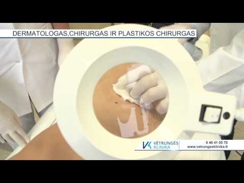 Video: Tiesa ir spėlionės apie plastinę chirurgiją