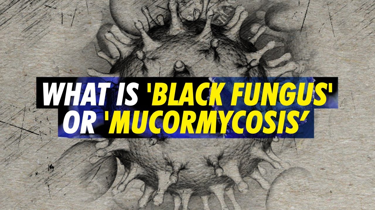 Black Fungus Or Mucormycosis Deadly Fungal Infection Making Some Covid 19 Patients Blind In India Youtube