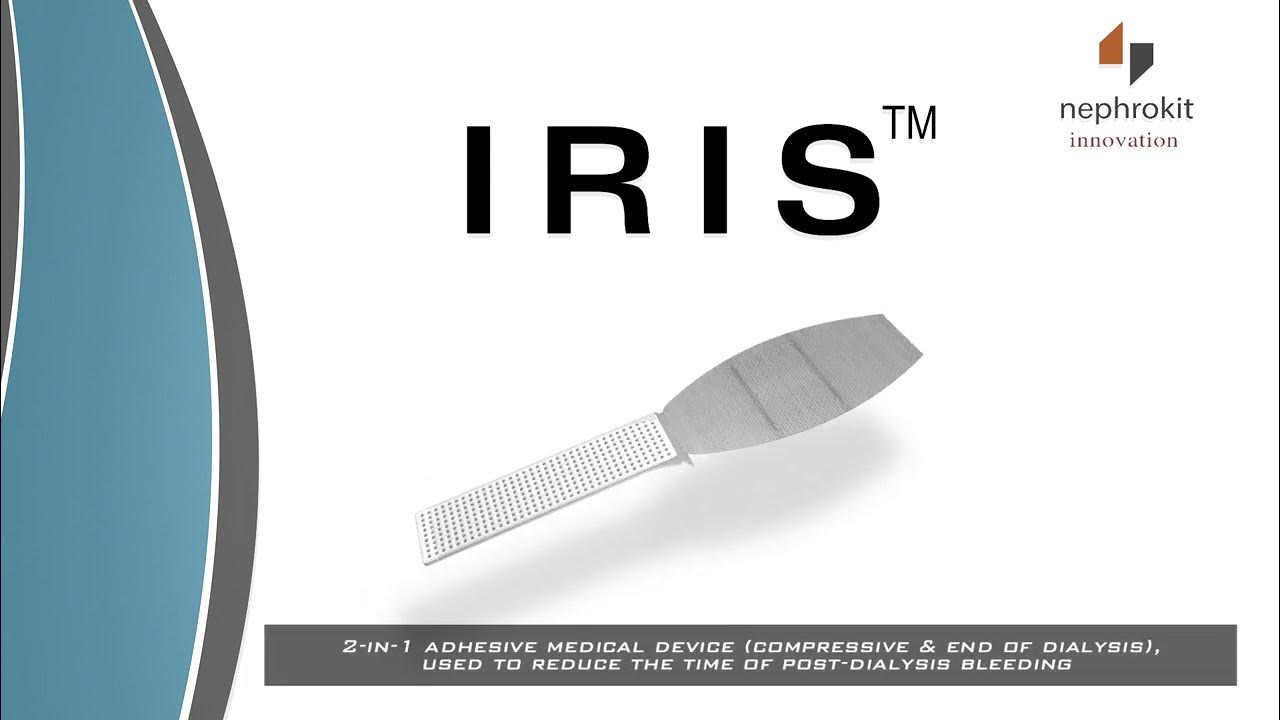 Discover The Iris Medical Device YouTube discover-the-iris-medical-device-youtube