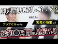 【対談】糸リフトはやっぱり詐欺？ 経験者が語る、顔の脂肪吸引+糸リフトの実態