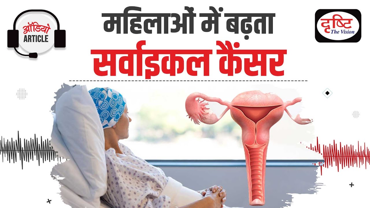 Increasing rate of Cervical Cancer in Women | Audio Article | Drishti IAS