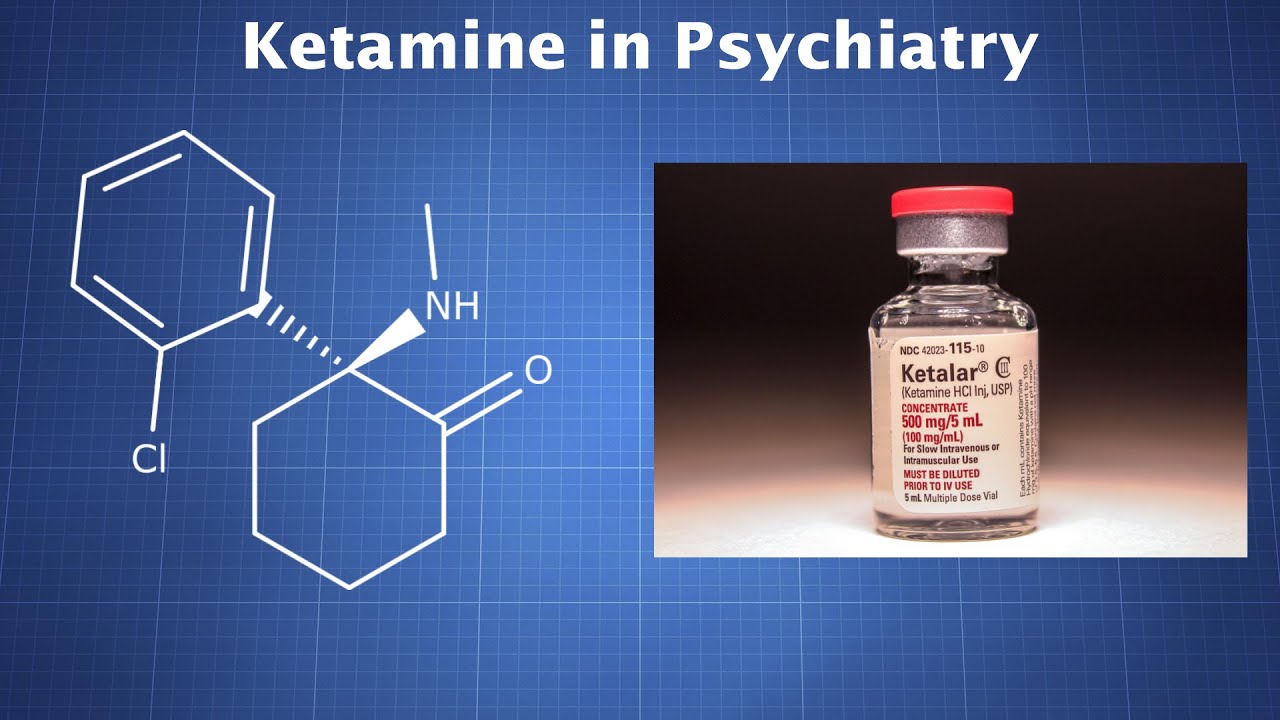 Ketamine in psychiatry how it affects depression anxiety and more