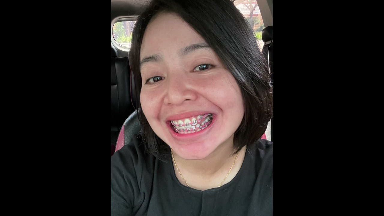 Foto Review setelah kontrol ke 2 