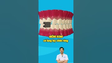Niềng răng có bị lung lay chân răng #rang #nhakhoa