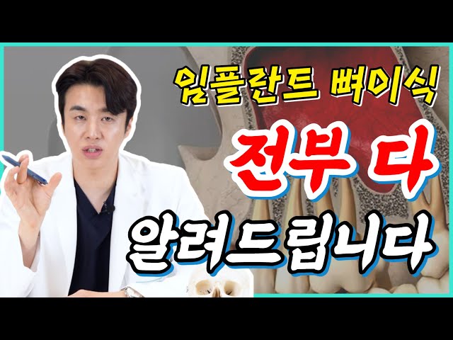 💥임플란트 뼈이식(상악동 거상술) 굳이 할 필요 없습니다. | 상악동거상술 부작용, 주의사항🔎