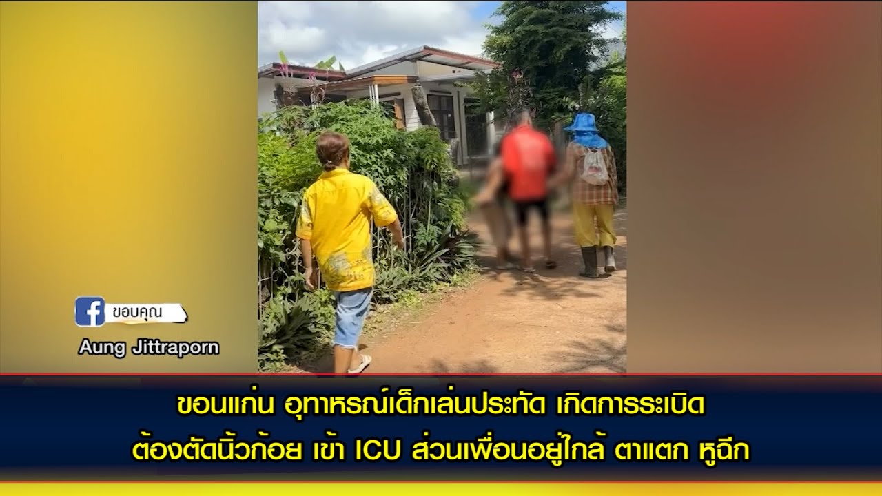 อุทาหรณ์เด็กเล่นประทัด เกิดการระเบิด เศษกระเด็นถูกศีรษะเปิดสมองไหล ส่วนเพื่อนอยู่ใกล้ ตาแตก หูฉีก