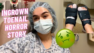 VLOG: Getting surgery for ingrown toenails