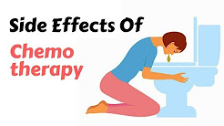 5 Side Effects of Chemotherapy For Cancer | You Should Know This 😱