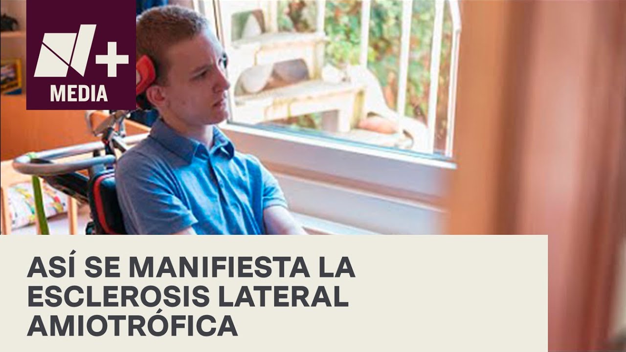 ¿Qué es la Esclerosis Lateral Amiotrófica (ELA)? - Bien y de Buenas