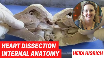 Heart Dissection Part 2: Internal Anatomy