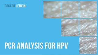 ✅ PCR analysis for HPV