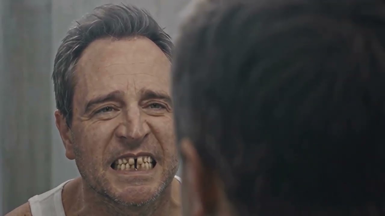 Can You Really Get Your Smile Back in One Morning With 21D? - YouTube