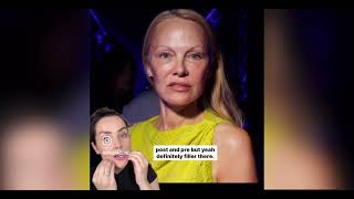Celebrity Aesthetics | Pamela Anderson: What has she had done?! Wealth