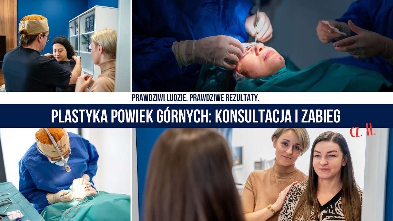 PLASTYKA POWIEK GÓRNYCH: konsultacja i zabieg, cz. II. Chirurgia plastyczna: dr Piotr Drozdowski