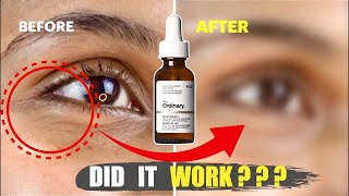 The Ordinary Age-Support Gf15% The Best Anti-Aging Serum?