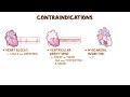 Cardiac glycosides: Nursing Pharmacology