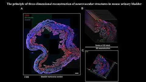 Three-Dimensional Reconstruction of Neurovascular Network