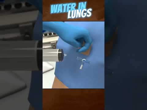 Water in Lungs