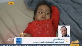 Unicef Spokesperson In Yemen Interview On Belqees Tv Comments On Unicef And Who Joint Conference