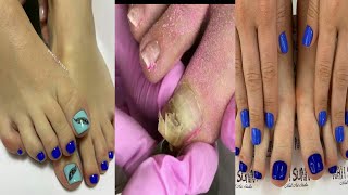 Most Satisfying Pedicure transformation 😱 best nail polish for toes 2020